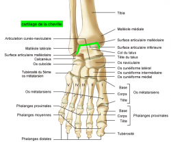 ARTHROSE DE CHEVILLE