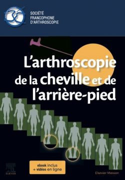 Livre arthroscopie de cheville